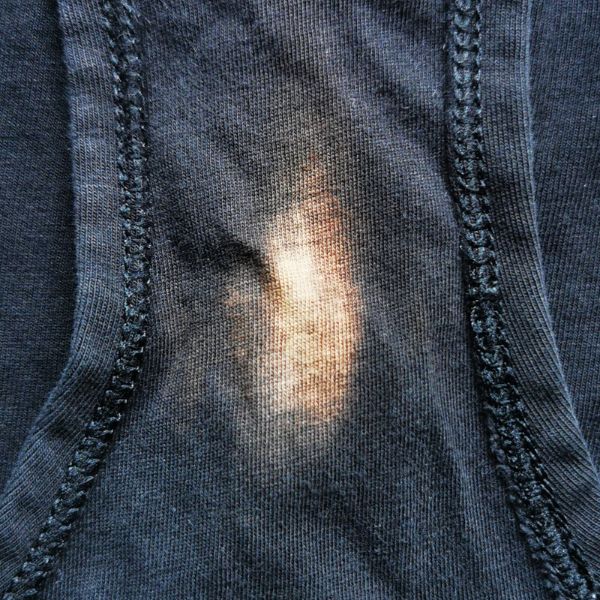 Vaginal Discharge Bleaches Dark Pants